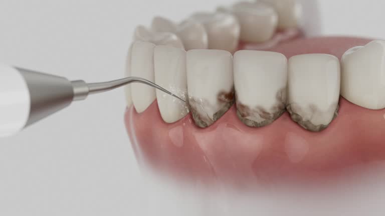 Reliable Teeth Cleaning And Checkup contractor in Pasadena, TX by Smile Center Dentistry